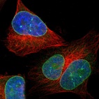 Immunofluorescent staining of human cell line U-251 MG shows localization to nuclear membrane.