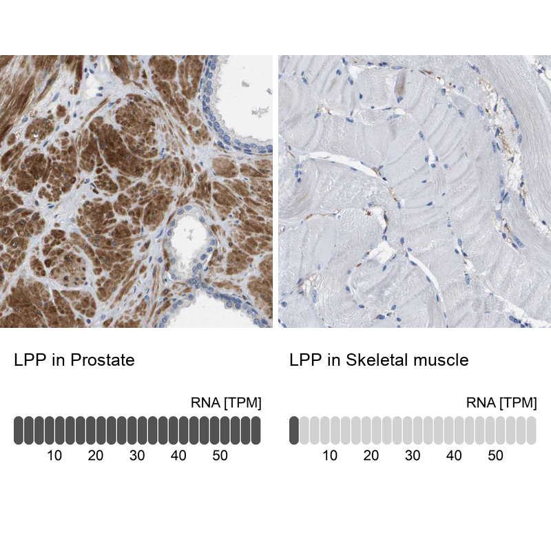 Anti-LPP Antibody