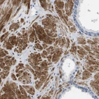 Immunohistochemical staining of human prostate shows strong cytoplasmic positivity in smooth muscle cells.