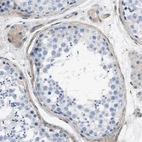 Immunohistochemical staining of human testis shows moderate cytoplasmic positivity in peritubular myoid cells.