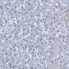 Immunohistochemical staining of human liver shows no positivity in hepatocytes as expected.