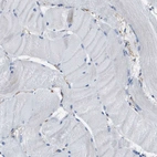 Immunohistochemical staining of human skeletal muscle shows no positivity in myocytes as expected.