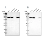 Western blot analysis using Anti-LPP antibody HPA017342 (A) shows similar pattern to independent antibody HPA011133 (B).