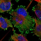 Immunofluorescent staining of human cell line U-251 MG shows localization to cytosol & focal adhesion sites.