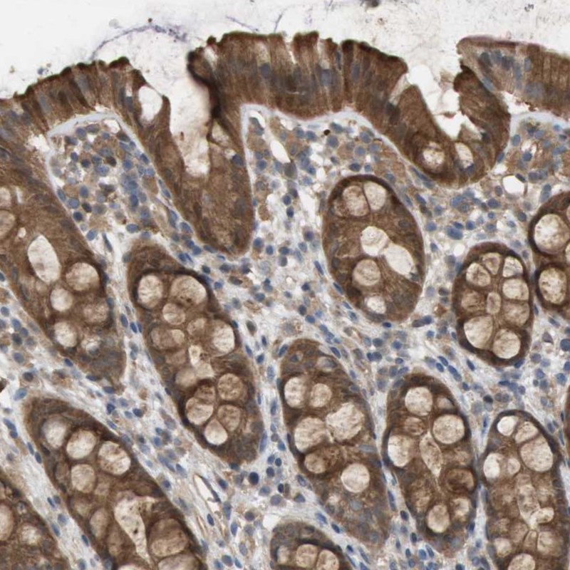 Anti-PALD1 Antibody