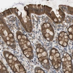 Anti-PALD1 Antibody