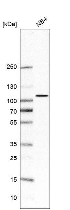 Western blot analysis in human cell line NB4.