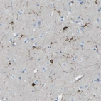 Immunohistochemical staining of human cerebral cortex shows weak to moderate cytoplasmic positivity in glial cells.