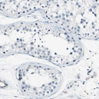Immunohistochemical staining of human testis shows no positivity in cells in tubules as expected.