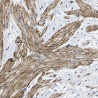 Anti-ADGRG6 Antibody