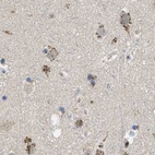 Immunohistochemical staining of human cerebral cortex using Anti-ZFPL1 antibody HPA017347.