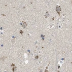 Immunohistochemical staining of human cerebral cortex using Anti-ZFPL1 antibody HPA017347.