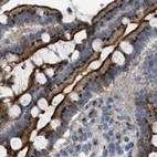 Immunohistochemical staining of human colon using Anti-ZFPL1 antibody HPA017347.