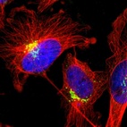 Immunofluorescent staining of human cell line U-251 MG shows localization to the Golgi apparatus.