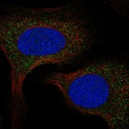 Anti-SPCS2 Antibody