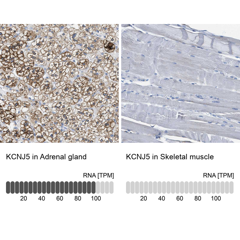 Anti-KCNJ5 Antibody
