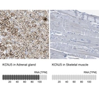 Anti-KCNJ5 Antibody