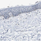 Immunohistochemical staining of human skin shows no positivity in squamous epithelial cells as expected.