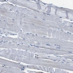 Immunohistochemical staining of human skeletal muscle shows no positivity in myocytes as expected.