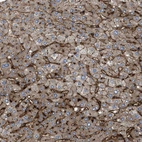 Immunohistochemical staining of human liver shows strong membranous positivity in hepatocytes.