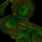 Immunofluorescent staining of human cell line LHCN-M2 shows localization to nucleoplasm, plasma membrane & cytosol.