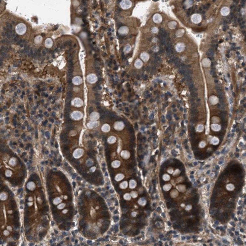Anti-EPSTI1 Antibody