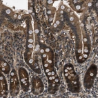 Anti-EPSTI1 Antibody