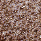 Immunohistochemical staining of human parathyroid gland shows strong membranous and cytoplasmic positivity in glandular cells.