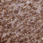 Anti-CHGA Antibody