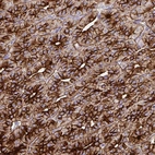 Immunohistochemical staining of human parathyroid gland shows strong membranous and cytoplasmic positivity in glandular cells.