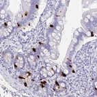 Immunohistochemical staining of human duodenum shows strong cytoplasmic positivity in enteroendocrine cells.