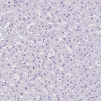 Immunohistochemical staining of human liver shows no positivity in hepatocytes as expected.