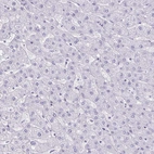 Immunohistochemical staining of human liver shows no positivity in hepatocytes as expected.