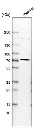 Anti-CHGA Antibody