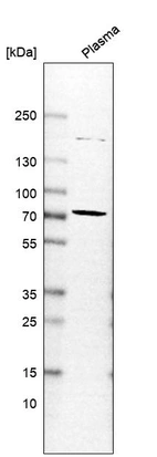 Western blot analysis in human plasma.