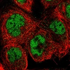 Immunofluorescent staining of human cell line A-431 shows localization to nucleoplasm.