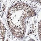 Immunohistochemical staining of human Testis shows strong cytoplasmic positivity in cells in seminiferous ducts.