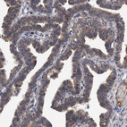 Immunohistochemical staining of human Fallopian tube shows moderate cytoplasmic positivity in glandular cells.