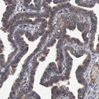 Immunohistochemical staining of human Fallopian tube shows moderate cytoplasmic positivity in glandular cells.