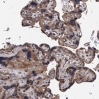 Immunohistochemical staining of human Placenta shows moderate cytoplasmic positivity in trophoblastic cells.