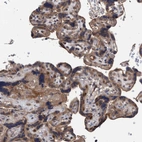 Immunohistochemical staining of human Placenta shows moderate cytoplasmic positivity in trophoblastic cells.