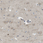 Immunohistochemical staining of human cerebral cortex shows weak cytoplasmic positivity in neurons.