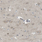 Immunohistochemical staining of human cerebral cortex shows weak cytoplasmic positivity in neurons.