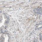 Immunohistochemical staining of human prostate shows weak cytoplasmic positivity in smooth muscle cells.