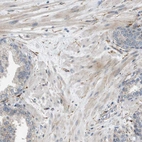 Immunohistochemical staining of human prostate shows weak cytoplasmic positivity in smooth muscle cells.