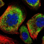 Immunofluorescent staining of human cell line A-431 shows localization to cytosol.
