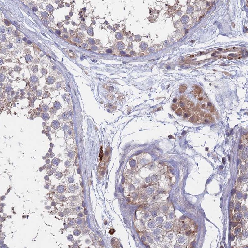 Anti-TMBIM6 Antibody