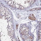 Anti-TMBIM6 Antibody