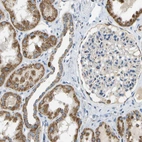 Anti-HLCS Antibody