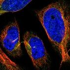 Immunofluorescent staining of human cell line U-2 OS shows localization to cytosol.